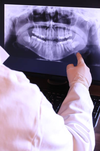 Best Emergency Dental Care for Abscessed Tooth in Nutter Fort, WV