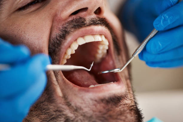 Best Mobile Emergency Dentist in Nutter Fort, WV