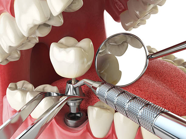 Best Pediatric Emergency Dentist in Nutter Fort, WV